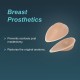 Tynor Breast Prosthesis (B 30) (H 19)