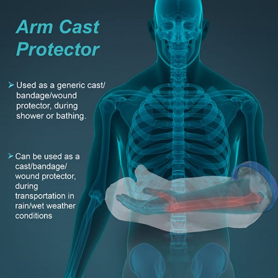 Tynor Cast Arm Cover (One Size) (C 19)